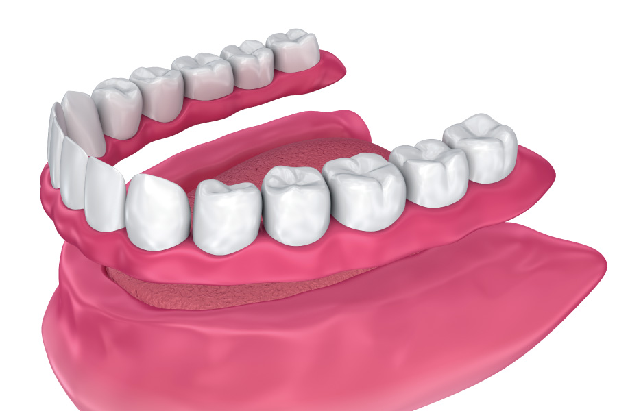 Everett IMmediate Dentures